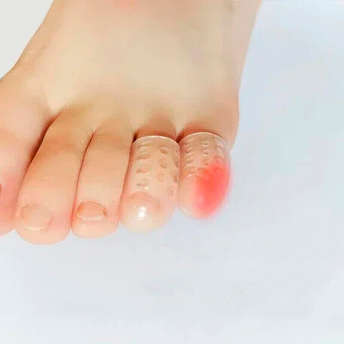 ToeProtector, silikonski štitnik za prste (10 komada) - Image 8